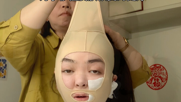 Ten Days Post-Facial Expansion Surgery!