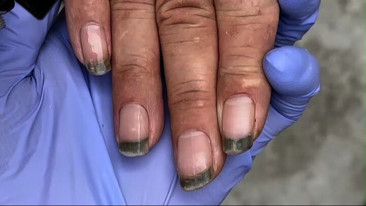 Dirty nails! There is a pile of black mud between the nails