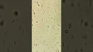 Kefir Under Microscope (Probiotic Drink)