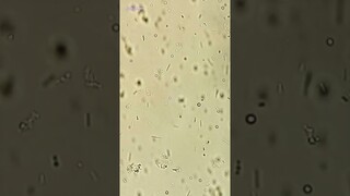 Kefir Under Microscope (Probiotic Drink)