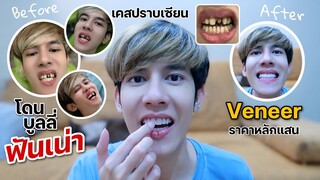 ฟันเน่า!! ประสบการณ์ทำวีเนียครั้งแรก กับความลับที่ไม่เคยบอกใคร | Fararim Story