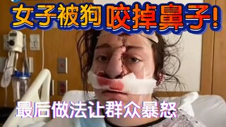 Phụ nữ bị chó nhà "cắn đứt mũi"! Cách xử lý cuối cùng khiến cư dân mạng phẫn nộ tột độ!