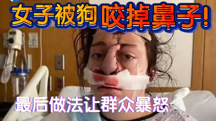 امرأة عضّ كلب المنزل أنفها! والطريقة التي اتُّبِعت في النهاية أثارت غضب المستخدمين بشدة!