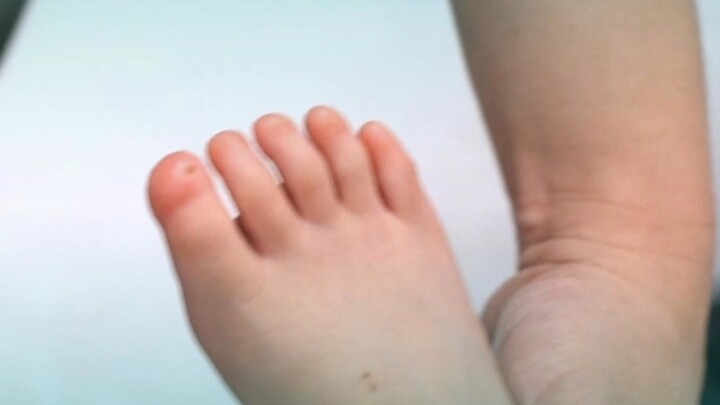 The child’s fingernails and toenails don’t grow at all; if it’s impossible to deal with in China, it