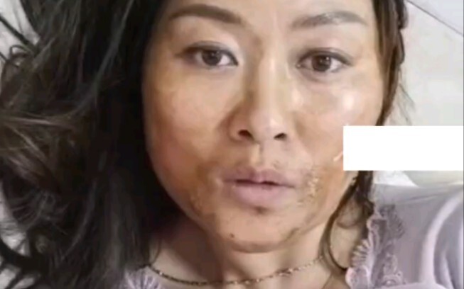 After testing positive, the woman no longer recognized her own mother.