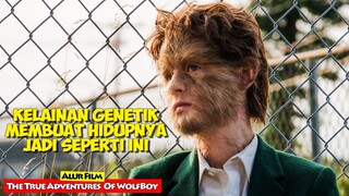 Kisah Anak Manusia Yang Memiliki Kelainan Genetik | Alur Cerita Film TRUE ADVENTURES OF WOLF BOY