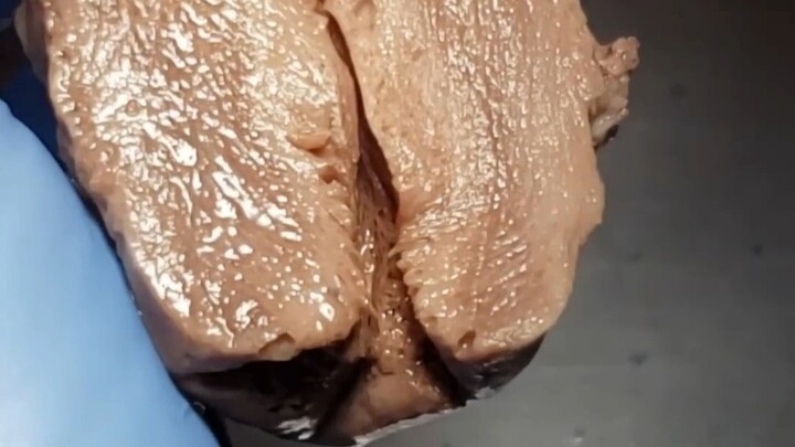 This small hole is the cervix, which is a very important structure in a girl's body.