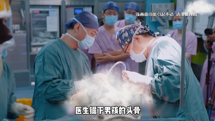 男孩脑袋畸形总是被同学嘲笑，妈妈只能带着他冒险做开颅手术 #纪录片