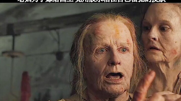 An elderly woman glued her sagging skin to marry the king