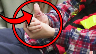 ได้รับบาดเจ็บสาหัสจากกล้อง เพียงเพื่อหัวเราะมุข