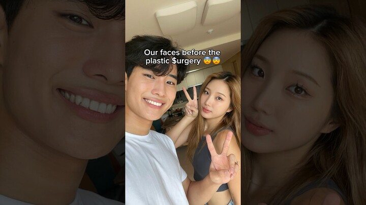 Korean Plastic Surgery is the best ✨