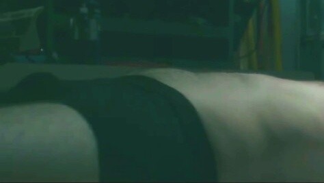 031. Man wakes up to find himself strapped to an operating table