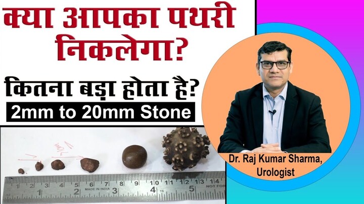 How to Measure Kidney Stone Size || Dr. Raj Kumar Sharma - Urologist