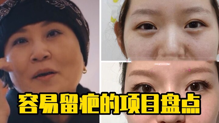 A rundown of projects that easily leave scars