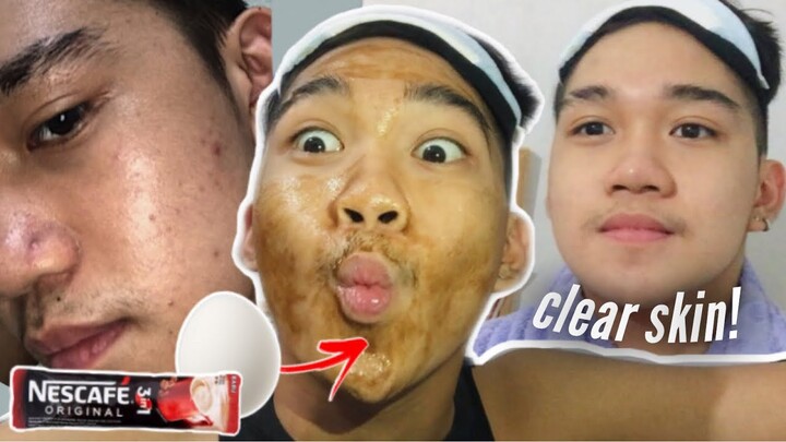 TRENDING! COFFEE + EGG WHITE MASK (CLEAR SKIN IS REAL! / 7 DAYS REVIEW) | Marcus Chleone