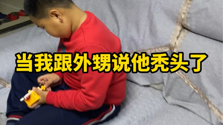 孩子年纪轻轻秃头了怎么办，看到最后才是正解