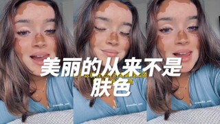 What’s beautiful is never skin color.