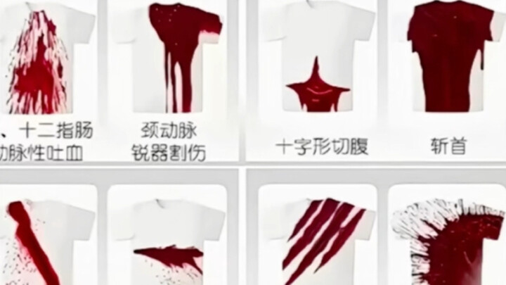 Bloodstains from injuries to different body parts… gunshot wounds from a burst of fire…