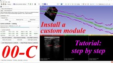 How to install a custom extension module- #00-C. 3D Slicer Tutorial step by step