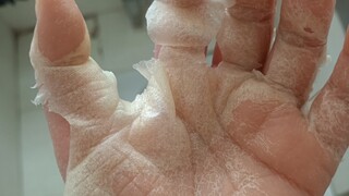 Vào ngày thứ ba của cuộc đấu tranh hấp hối của tôi trong bệnh viện