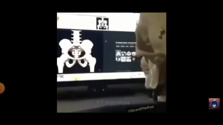 กระดูก