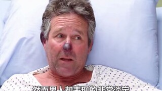 医生把水蛭放病人脸上，病人竟把水蛭当宠物养