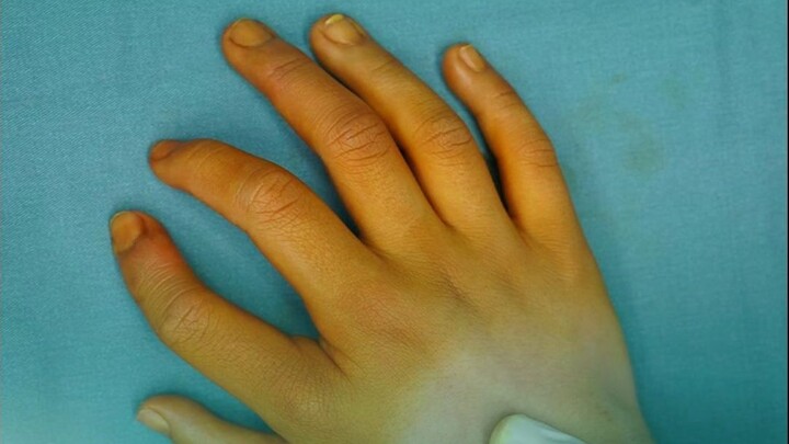 นิ้วมือของหนูน้อยดูแปลกๆ แล้วตกลงนิ้วไหนกันแน่ที่เป็นนิ้วโป้ง?