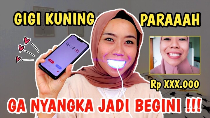 SHOPEE HAUL PEMUTIH GIGI TERAMPUH II BEAU DE LAB