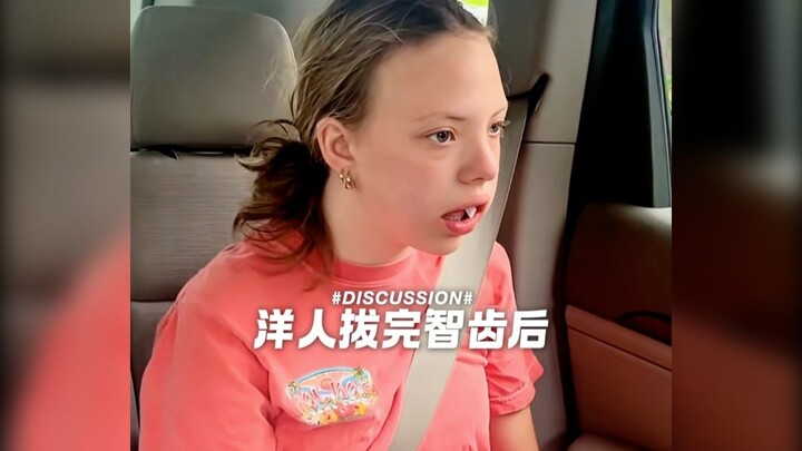 Phản ứng của người nước ngoài sau khi nhổ răng khôn