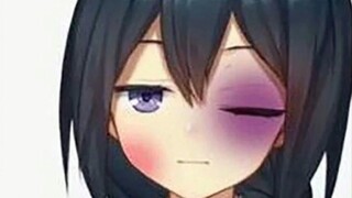 【Miki】Hidung Miki memar dan wajah bengkak.jpg&mp3