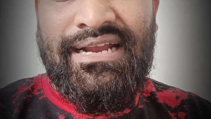 বিদ্যুৎ সমস্যা নয় অতিরিক্ত মাছ থাকায় মাছ মারা গেছে