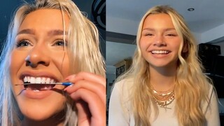 Why This 19-Year-Old TikToker Used a Nail File on Her Teeth