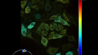 LIFA Toggel / FLIM Time Lapse of Hela Cells