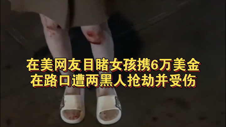 “Netizen AS Saksikan Seorang Gadis Dijambret dan Terluka oleh Dua Pria Kulit Hitam di Persimpangan J