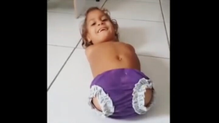 Anak kecil tanpa kedua tangan dan kaki bermain di lantai