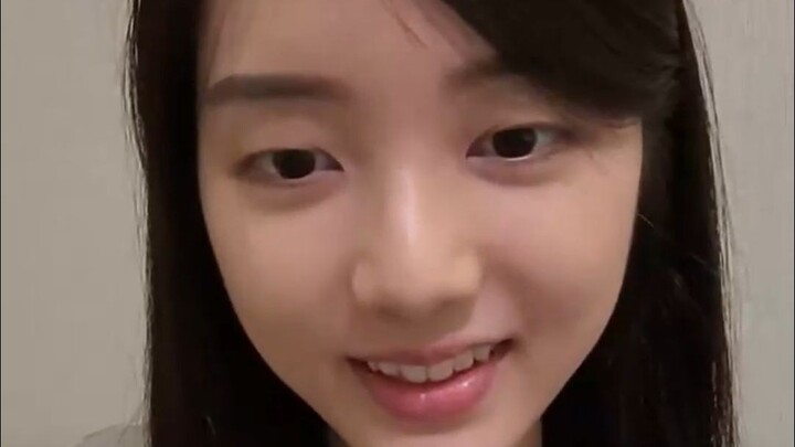 Yu Lijun: Maksudmu suruh aku operasi kelopak mata ganda? Tapi kalau begitu, orang tuaku pasti sedih.