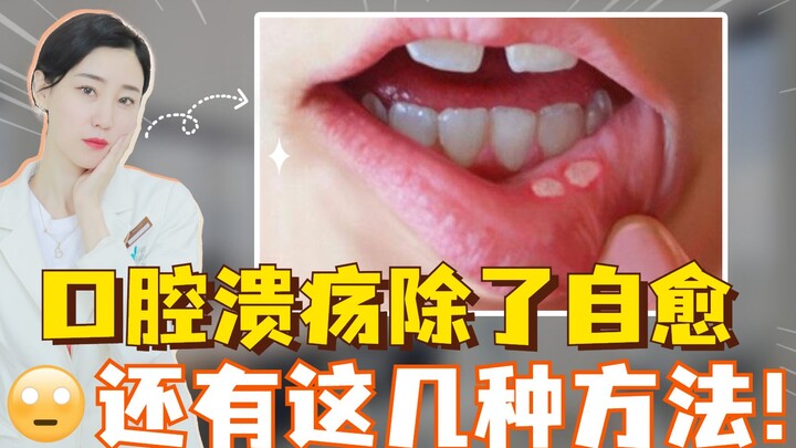 口腔溃疡，除了自愈，还有这几种方法！