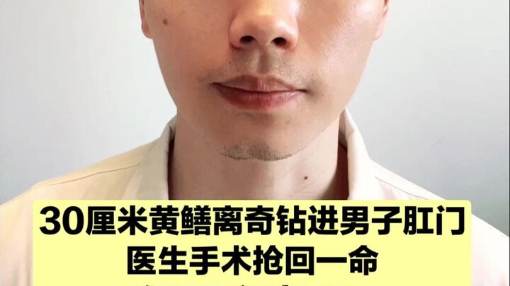 Belut kuning sepanjang 30 cm anehnya masuk ke anus pria, berhasil diselamatkan melalui operasi—tapi 