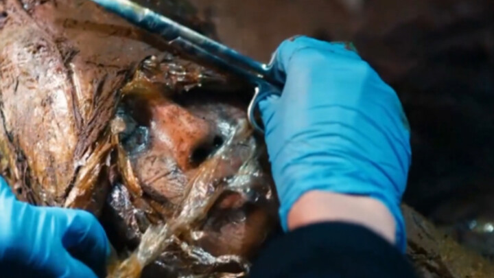 What on earth could someone’s motive be for using a woman’s uterus to breed spiders...?