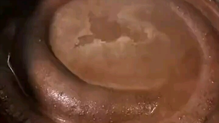 بتعمل دمّة؟ النوع اللي بيرشق دم! 😂😂😂