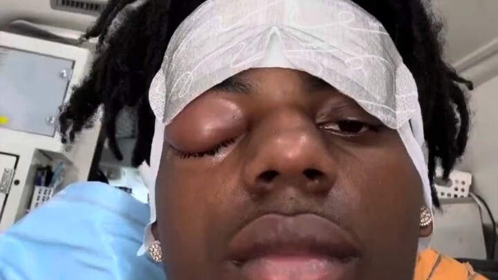 Brother Hyperthyroid suddenly falls ill and needs surgery