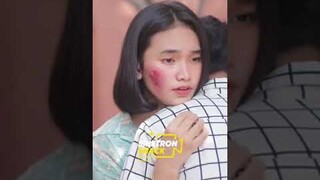 Bekas Luka Buat Minder