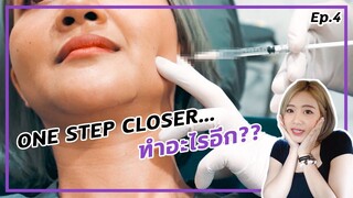 ตัดไหมหลังแก้จมูกแบบโอเพ่น ครบ16วัน | ONE STEP CLOSER... | CHANGE EP.4 | ENG SUB