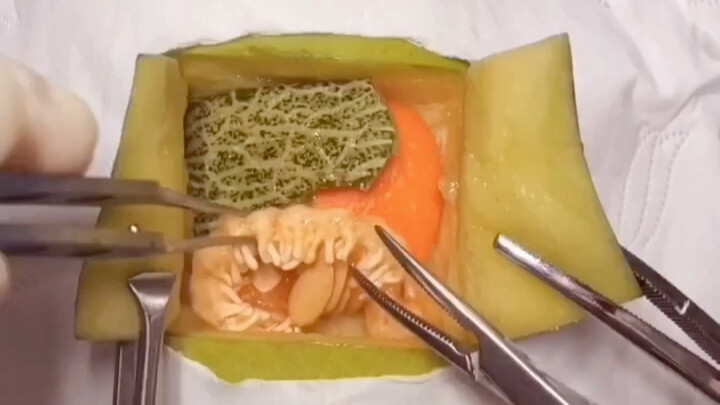 Kamu belum pernah lihat penampilanmu di ruang operasi? Aku bawa kamu lihat.