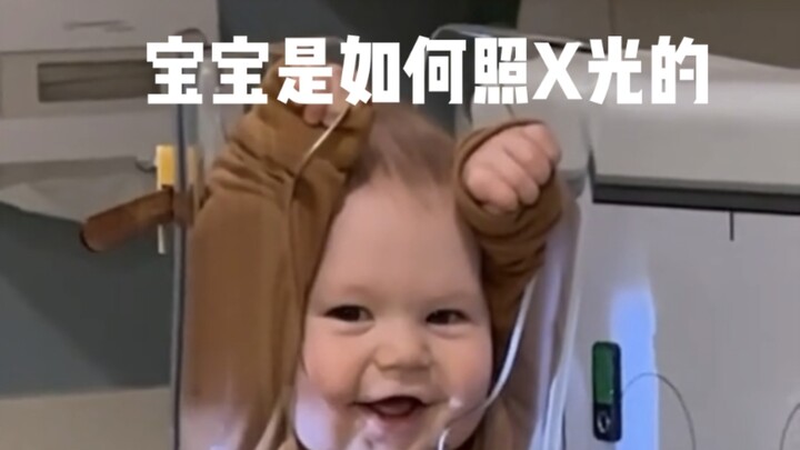 How Babies Undergo X-Ray Exams