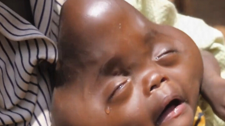 Bọn Nhật xả nước nhiễm xạ, giờ đang tự gánh hậu quả. #NhậtBản #XảNướcNhiễmXạ