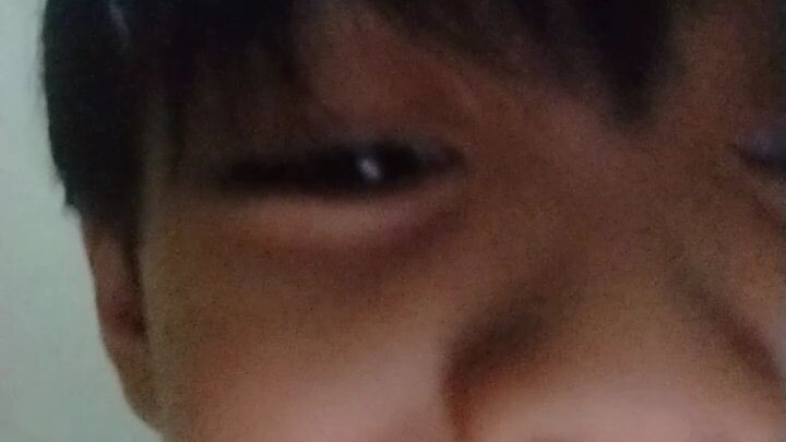 BoMbAsTiC sIdE eYe🤨