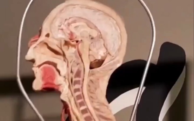 Cut a person down the center; the specimen is as follows.