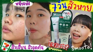 7วันสิวหาย แน่นะวิ❓ รีวิวเจลแต้มสิวsmooto จะลดสิว รอยสิวเร่งด่วน ที่กดสิวจนสิวเห่อเต็มคาราเบล ได้ไหม