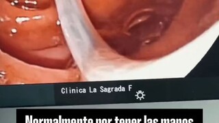 what the😲 ★video not mine